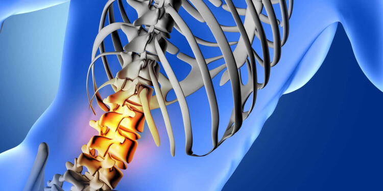 Ocho de cada diez mexicanos enfrenta problemas de columna vertebral: Una crisis de salud silenciosa