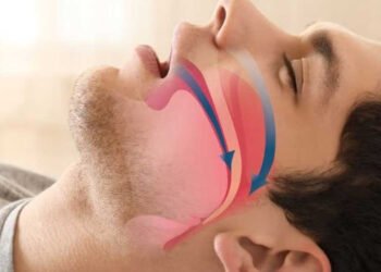 Apnea del sueño: ¿Qué pasa cuando dejas de respirar mientras duermes?